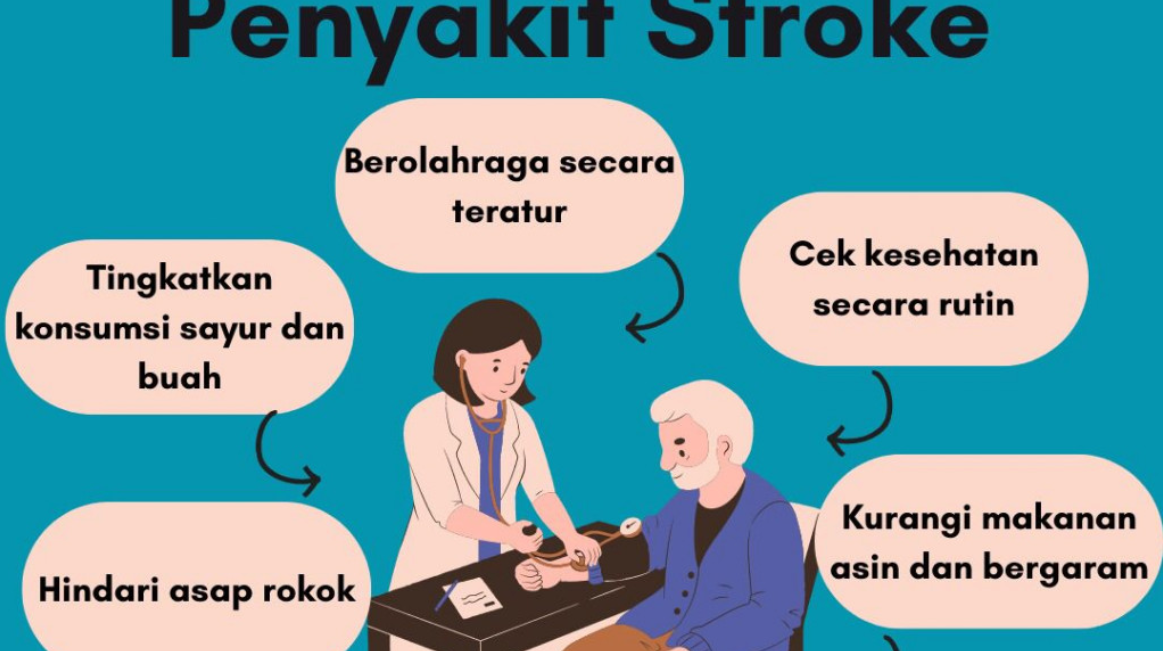 Langkah Awal Menghadapi Stroke: Pilihan Pengobatan  yang Benar-Benar Efektif